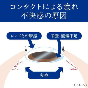 스마일 화이티에 콘택트