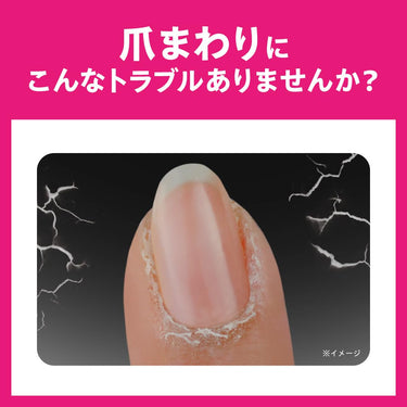 チュメキュア