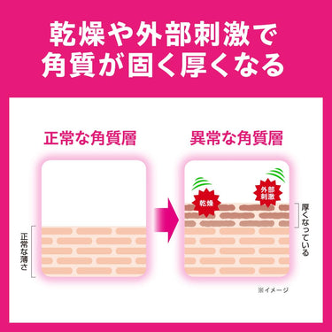 チュメキュア