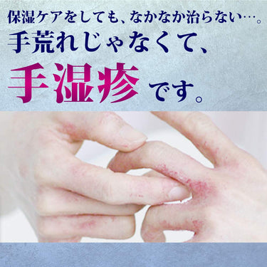 曼秀雷敦 醫療快效霜 S