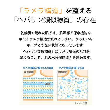 ヘパソフト 薬用 顔ローション