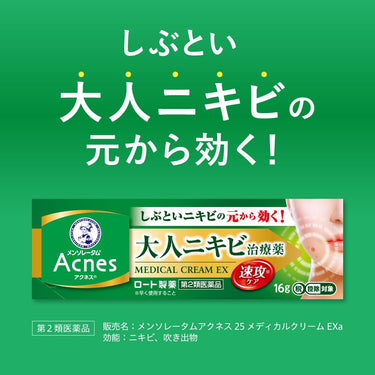 Mentholatum Acnes 25 Medical Cream EXa