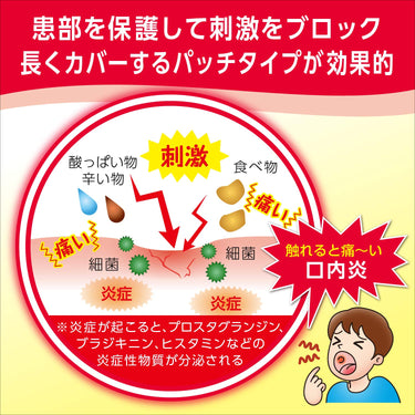 口內炎 藥貼 大正快速護理