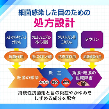 신설파글리칠 아이리스